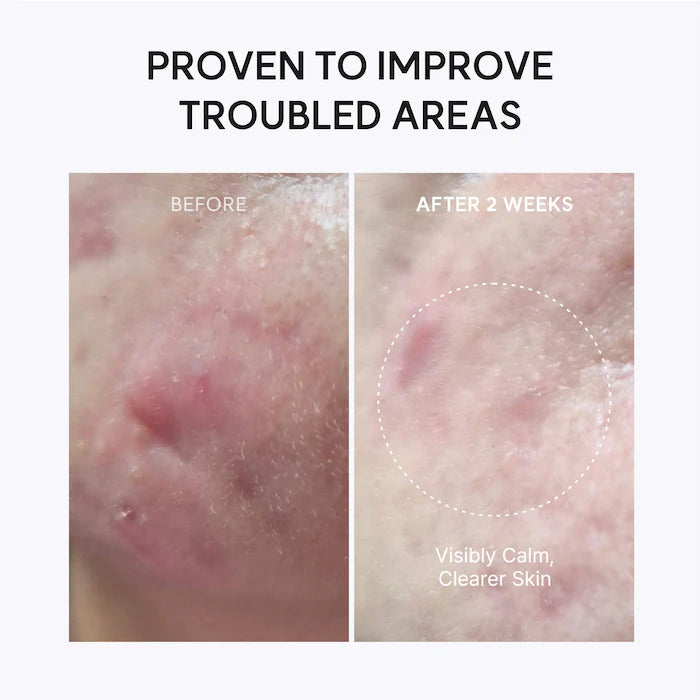 Arencia Eraser Shot Glycolic Acid Booster 30 ml